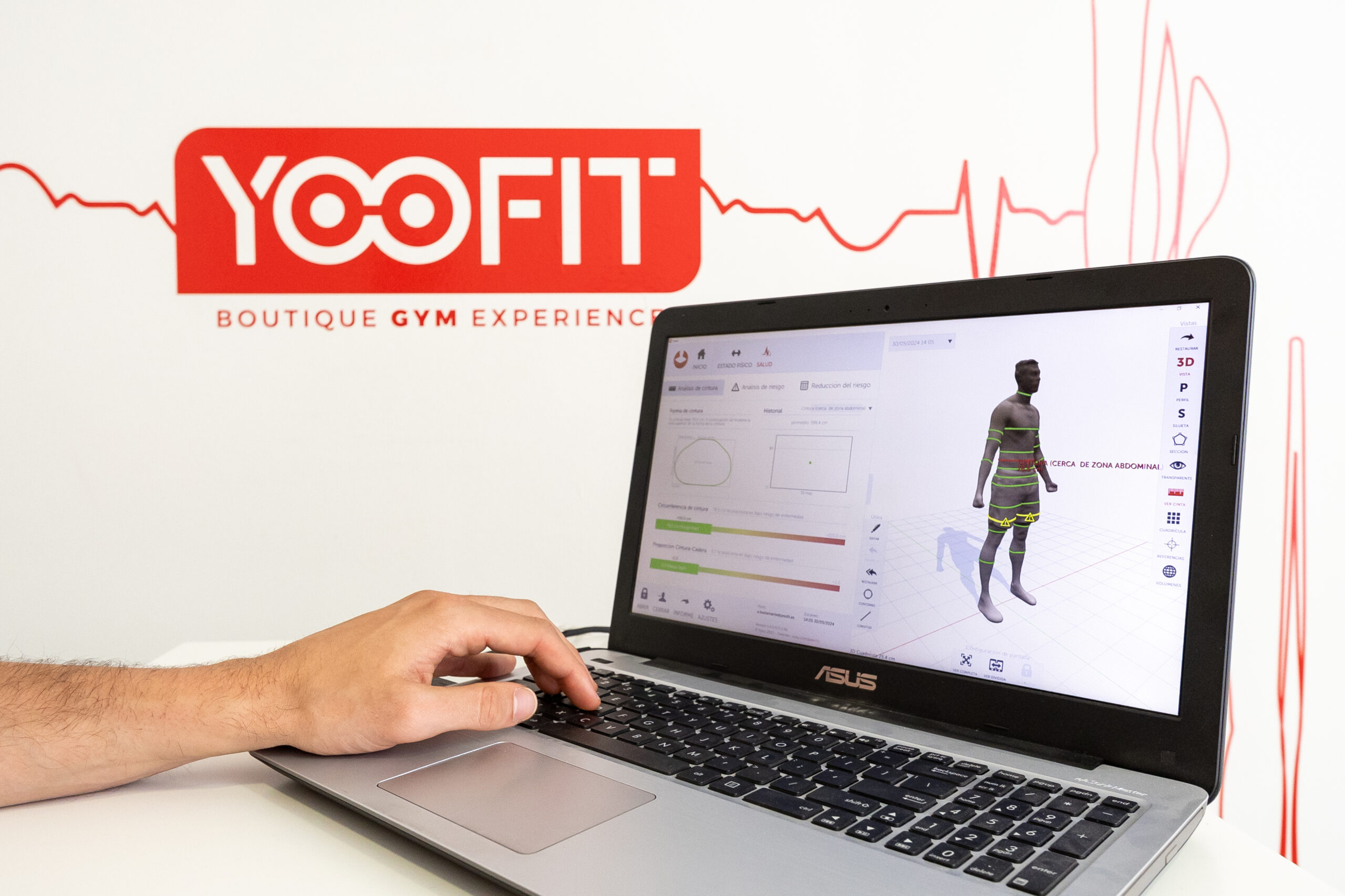 Yoofit-_68A8287-Editar-scaled